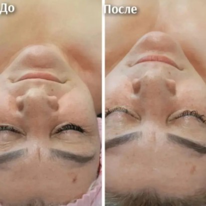 Курсы профессионального массажа